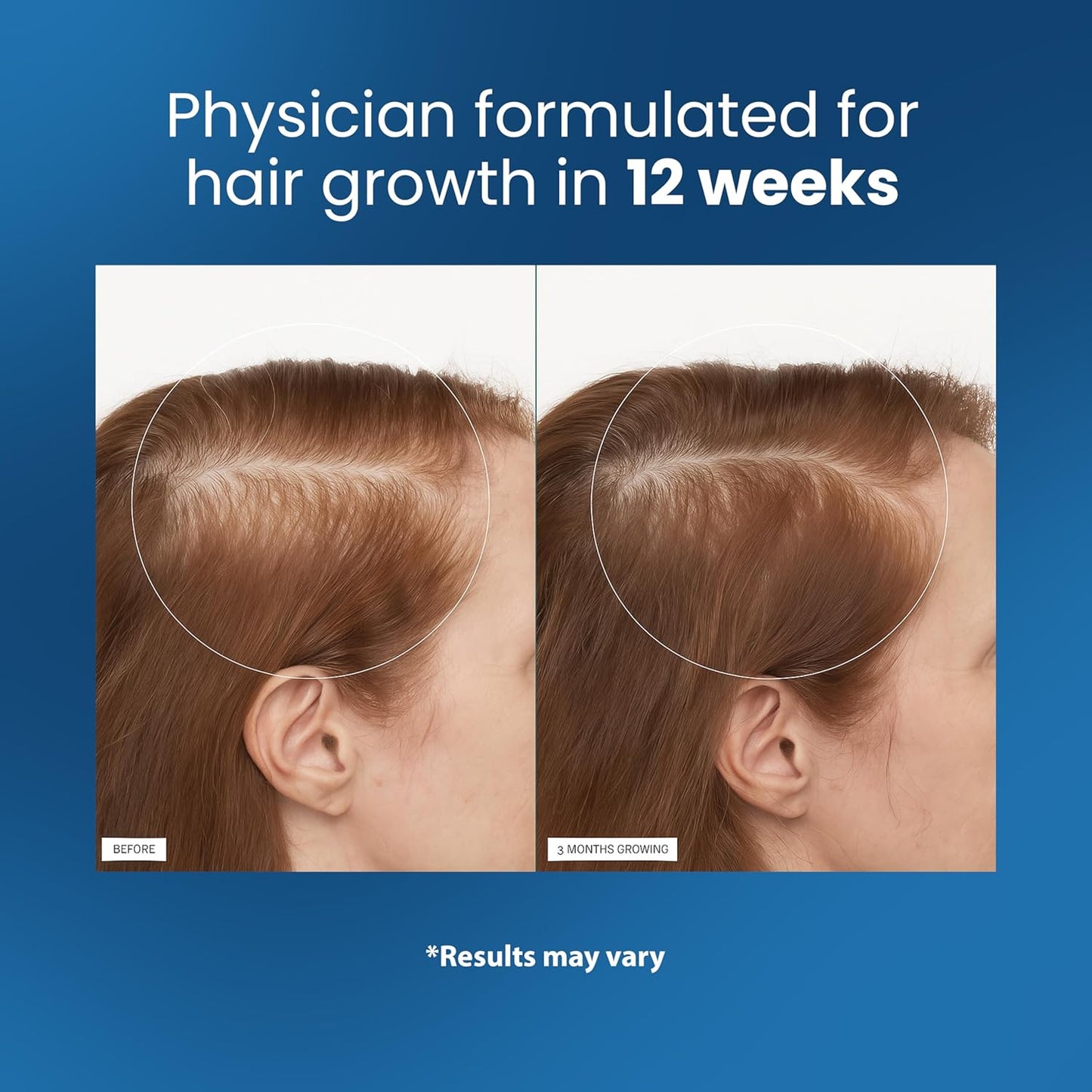 Revoira Hair Roll-On Serum