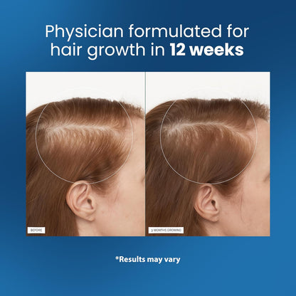 Revoira Hair Roll-On Serum